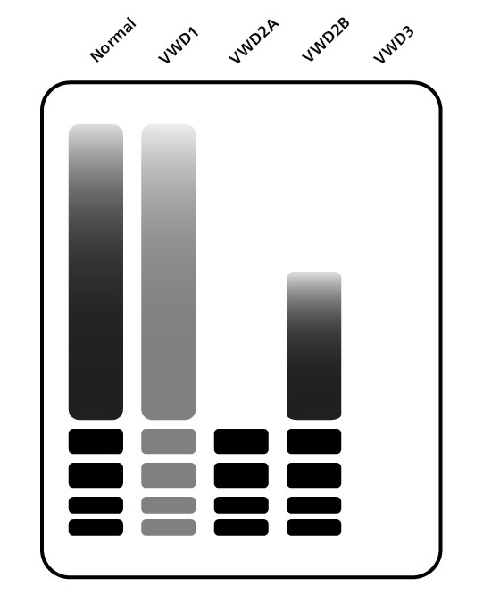 Typical vWD multimer analysis results