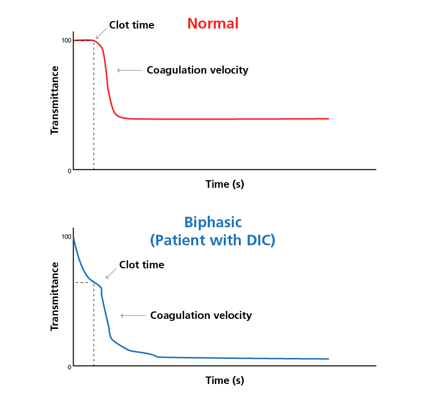 Sample activated partial thromboplastin time clot waveform