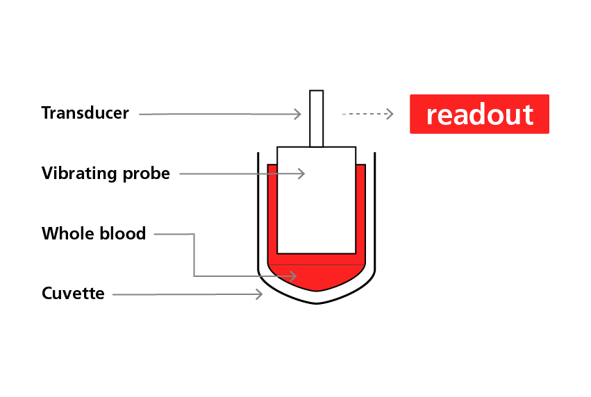 The principle behind sonoclot analysis3,4