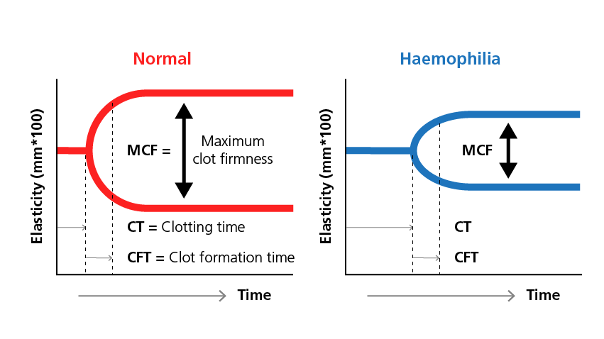 Sample thromboelastography readings 