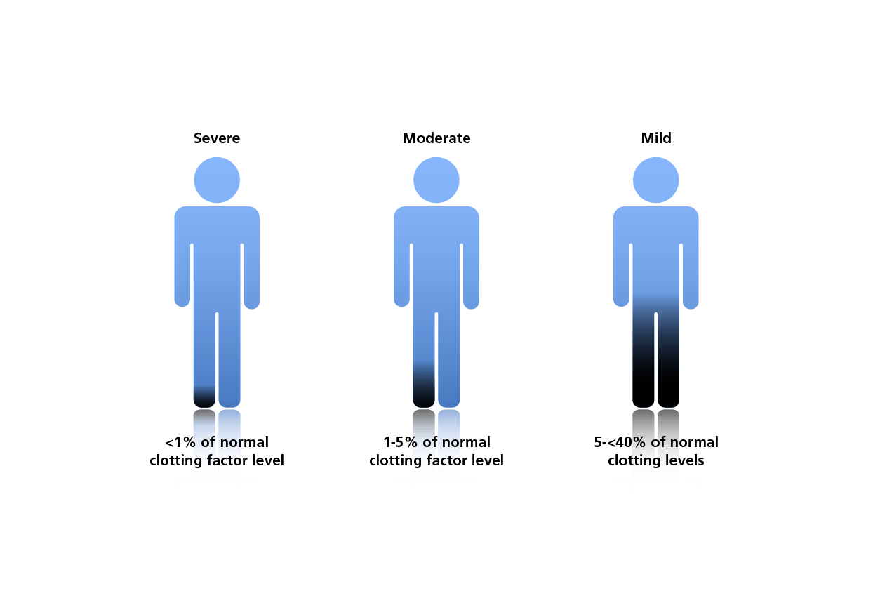 Classification of Haemophilia A according to clotting levels