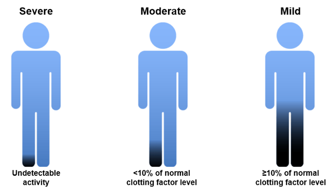 Classification of FV CD according to clotting factor levels