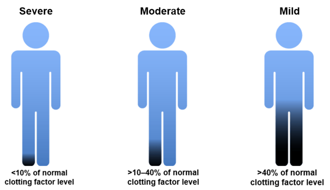 Classification of FX CD according to clotting factor levels