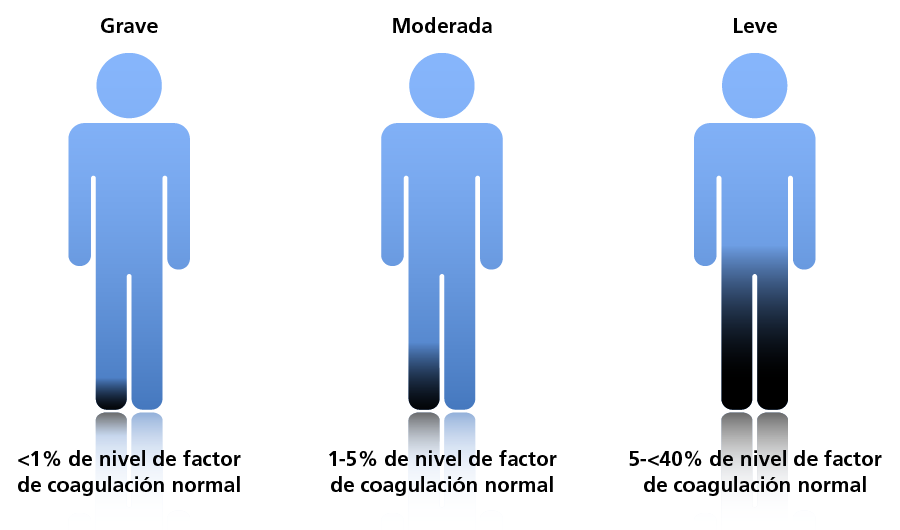 Classification of Haemophilia A according to clotting levels