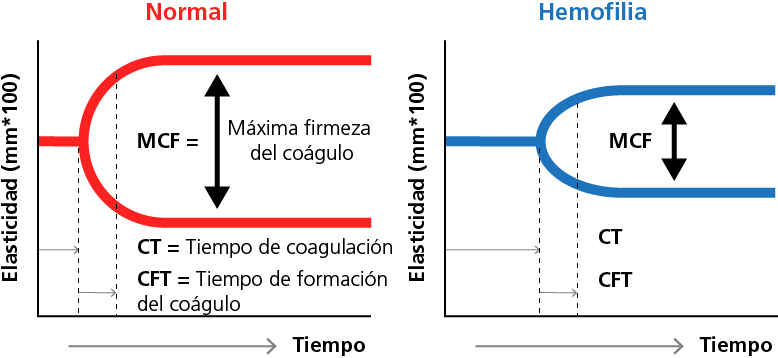 Sample thromboelastography readings 