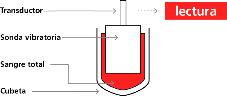 The principle behind sonoclot analysis3,4