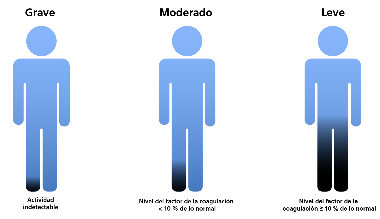 Classification of FV CD according to clotting factor levels