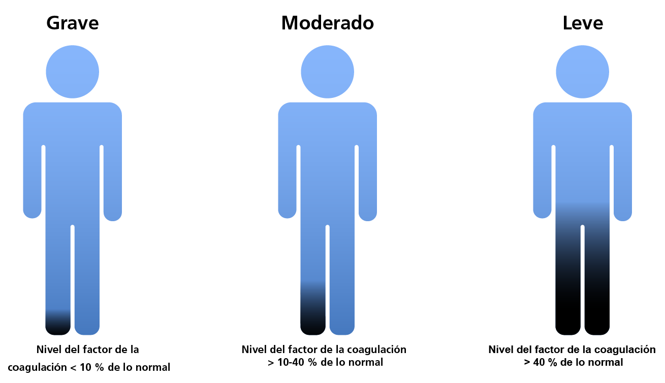 Classification of FX CD according to clotting factor levels