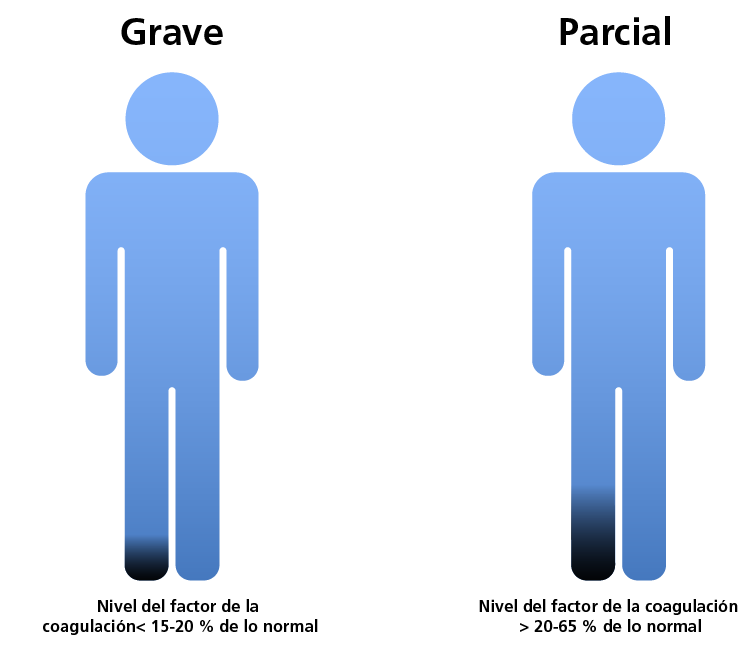 Classification of FXI CD according to clotting factor levels